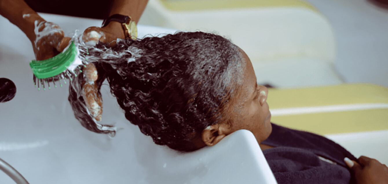 hair-loss