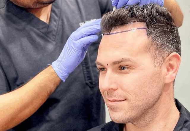hairline drawing hairline drawing